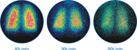 Alto flujo, administración eficaz de la medicación