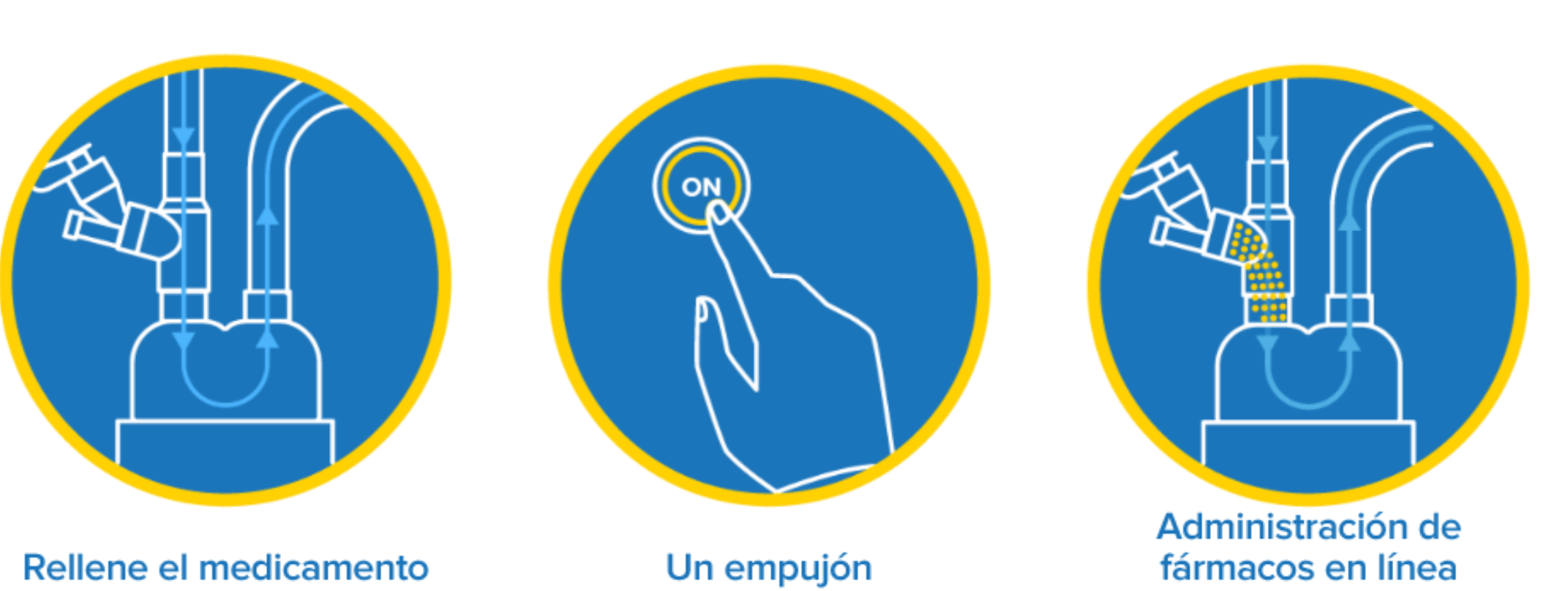 Ventilación mecánica invasiva, 3 pasos