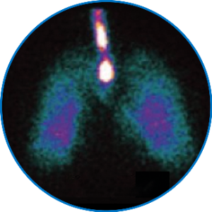 Ventilación mecánica invasiva, administración eficaz de la medicación